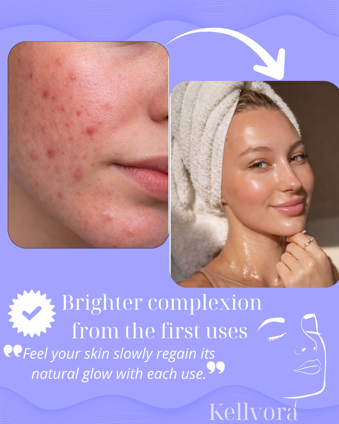 KELLVORA™ – LED Neck & Face Sculptor