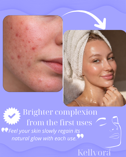 KELLVORA™ – LED Neck & Face Sculptor